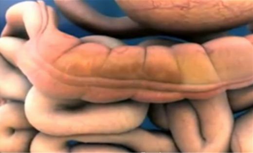 Bağırsak Florası Nasıl Düzelir?