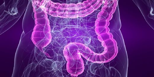 Bağırsak İltihabı Belirtileri ve Tedavisi