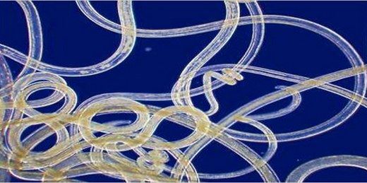 Bağırsak Kurdu Nasıl Dökülür?