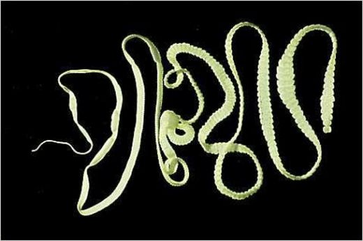 Bağırsak Tenyası Belirtileri ve Tedavisi