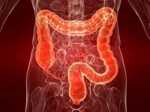 Bağırsak Ülseri Belirtileri ve Tedavisi